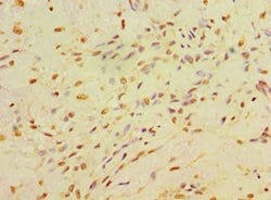 Invitrogen CA14 Polyclonal Antibody 100 &mu;L | Buy Online | Invitrogen&trade; | Fisher Scientific