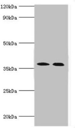 Invitrogen CA14 Polyclonal Antibody 100 &mu;L | Buy Online | Invitrogen&trade; | Fisher Scientific