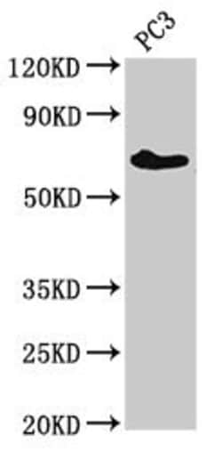 Invitrogen ICK Polyclonal Antibody 100 &mu;g; Unconjugated:Antibodies,