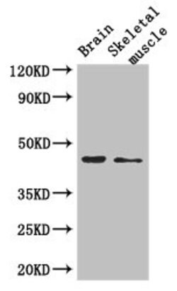 Invitrogen AJAP1 Polyclonal Antibody 100 &mu;g; Unconjugated:Antibodies,