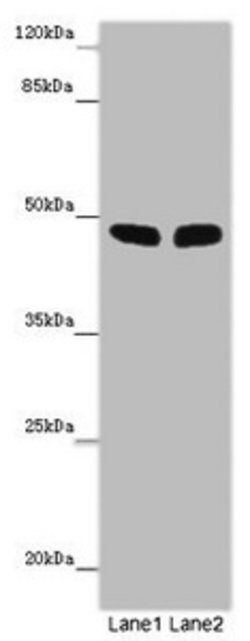 Invitrogen FBXL21 Polyclonal Antibody 100 μg; Unconjugated:Antibodies,