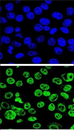 Invitrogen MDM2 Polyclonal Antibody 400 &mu;L; Unconjugated:Antibodies,