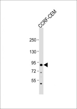 Invitrogen MDM2 Polyclonal Antibody 400 &mu;L; Unconjugated:Antibodies,