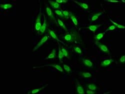 Invitrogen MAGED2 Polyclonal Antibody 100 μg; Unconjugated:Antibodies,