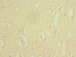 Invitrogen SCN8A Polyclonal Antibody 100 &mu;L | Buy Online | Invitrogen&trade; | Fisher Scientific