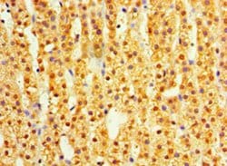 Invitrogen DIMT1 Polyclonal Antibody 100 &mu;g; Unconjugated:Antibodies,