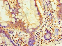 Invitrogen DIMT1 Polyclonal Antibody 100 &mu;g; Unconjugated:Antibodies,