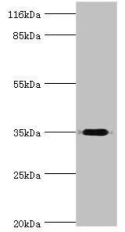 Invitrogen DIMT1 Polyclonal Antibody 100 &mu;g; Unconjugated:Antibodies,