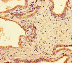 Invitrogen PPM1H Polyclonal Antibody 100 &mu;g; Unconjugated:Antibodies,