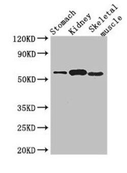 Invitrogen PPM1H Polyclonal Antibody 100 &mu;g; Unconjugated:Antibodies,