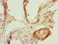 Invitrogen FBXL5 Polyclonal Antibody 100 μL; Unconjugated:Antibodies,