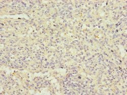 Invitrogen FBXL5 Polyclonal Antibody 100 μL; Unconjugated:Antibodies,
