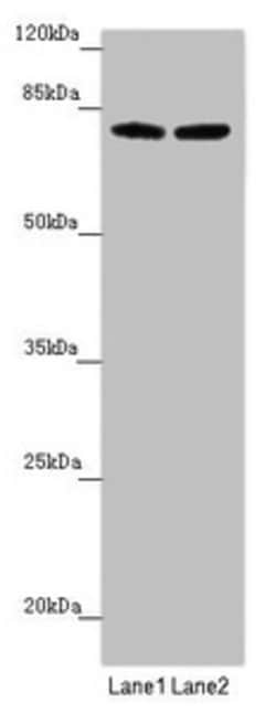 Invitrogen FBXL5 Polyclonal Antibody 100 μL; Unconjugated:Antibodies,
