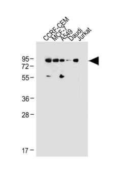 Invitrogen MDM2 Polyclonal Antibody 200 μL; Unconjugated:Antibodies,