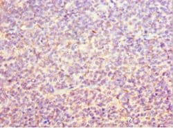 Invitrogen ORC6 Polyclonal Antibody 100 &mu;L; Unconjugated:Antibodies,