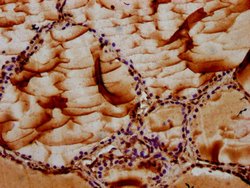 Invitrogen MAN2B2 Polyclonal Antibody 100 &mu;g; Unconjugated:Antibodies,