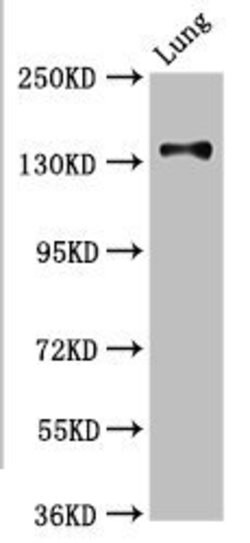 Invitrogen MAN2B2 Polyclonal Antibody 100 &mu;g; Unconjugated:Antibodies,