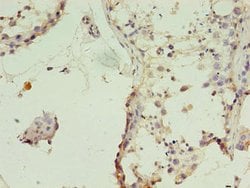 Invitrogen TIMM10B Polyclonal Antibody 100 &mu;g; Unconjugated:Antibodies,