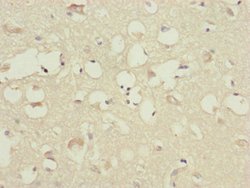 Invitrogen CEP83 Polyclonal Antibody 100 &mu;L; Unconjugated:Antibodies,