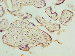 Invitrogen LRRC42 Polyclonal Antibody 100 &mu;g; Unconjugated:Antibodies,