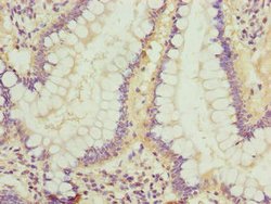 Invitrogen LRRC42 Polyclonal Antibody 100 &mu;g; Unconjugated:Antibodies,