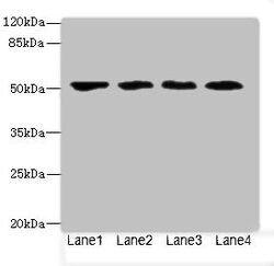 Invitrogen LRRC42 Polyclonal Antibody 100 &mu;g; Unconjugated:Antibodies,