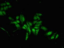 Invitrogen MAB21L2 Polyclonal Antibody 100 &mu;g; Unconjugated:Antibodies,