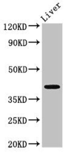 Invitrogen MAB21L2 Polyclonal Antibody 100 &mu;g; Unconjugated:Antibodies,