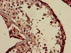 Invitrogen COQ6 Polyclonal Antibody 100 &mu;g; Unconjugated:Antibodies,