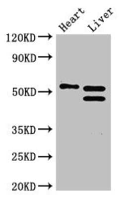 Invitrogen COQ6 Polyclonal Antibody 100 &mu;g; Unconjugated:Antibodies,