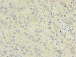 Invitrogen NME7 Polyclonal Antibody 100 &mu;g; Unconjugated:Antibodies,