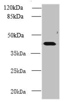 Invitrogen NME7 Polyclonal Antibody 100 &mu;g; Unconjugated:Antibodies,