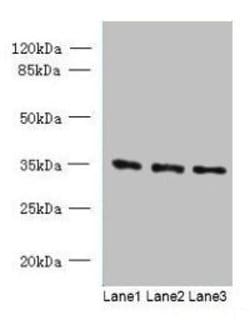 Invitrogen C15orf41 Polyclonal Antibody 100 &mu;g; Unconjugated:Antibodies,