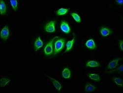 Invitrogen C11orf9 Polyclonal Antibody 100 &mu;g | Buy Online | Invitrogen&trade; | Fisher Scientific