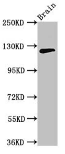 Invitrogen C11orf9 Polyclonal Antibody 100 &mu;g | Buy Online | Invitrogen&trade; | Fisher Scientific