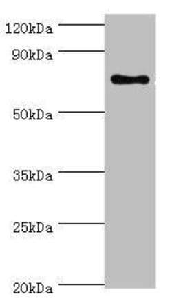 Invitrogen SLC27A6 Polyclonal Antibody 100 &mu;L; Unconjugated:Antibodies,