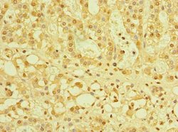 TZFP Polyclonal Antibody:Antibodies, Polyclonal