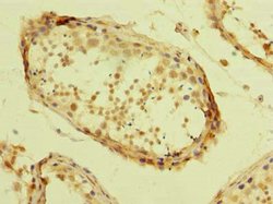TZFP Polyclonal Antibody:Antibodies, Polyclonal