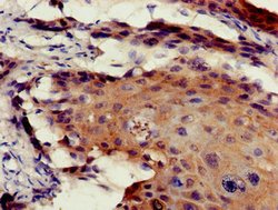 Invitrogen ETV7 Polyclonal Antibody 100 μg; Unconjugated:Antibodies,