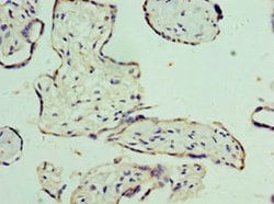 Invitrogen ORNT1 Polyclonal Antibody 100 μL; Unconjugated:Antibodies,