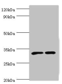 Invitrogen ORNT1 Polyclonal Antibody 100 μL; Unconjugated:Antibodies,