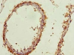 Invitrogen AP4B1 Polyclonal Antibody 100 &mu;g; Unconjugated:Antibodies,