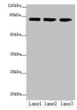Invitrogen AP4B1 Polyclonal Antibody 100 &mu;g; Unconjugated:Antibodies,