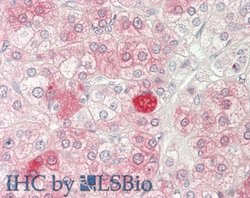 TIP60 Polyclonal Antibody:Antibodies, Polyclonal