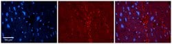 TIP60 Polyclonal Antibody:Antibodies, Polyclonal