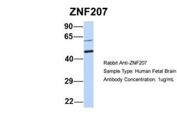 Invitrogen ZNF207 Polyclonal Antibody 100 &mu;L | Buy Online | Invitrogen&trade; | Fisher Scientific