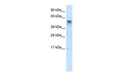 Invitrogen JMJD5 Polyclonal Antibody 100 &mu;L; Unconjugated:Antibodies,