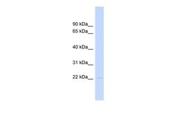Invitrogen HAND1 Polyclonal Antibody 100 &mu;L; Unconjugated:Antibodies,