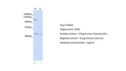 Invitrogen Atrophin 1 Polyclonal Antibody 100 &mu;L; Unconjugated:Antibodies,