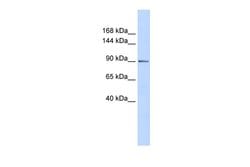 PHF16 Polyclonal Antibody:Antibodies, Polyclonal